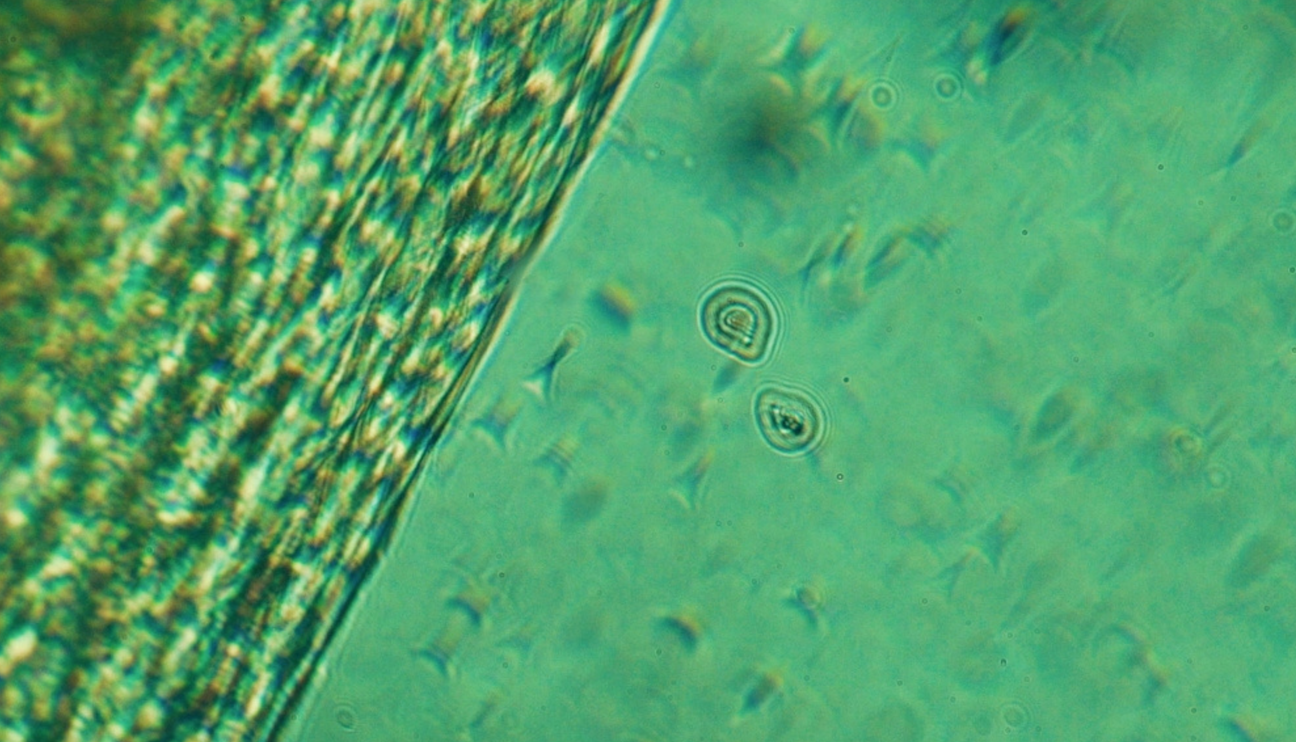 How To Detox From Microplastics (Without Losing Your Mind)