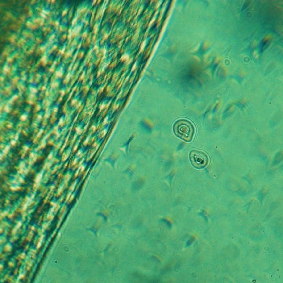 How To Detox From Microplastics (Without Losing Your Mind)